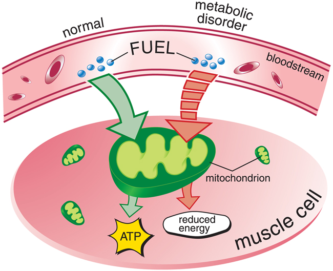 http://www.mda.org/disease/metabolic-diseases-of-muscle/causes-inheritance